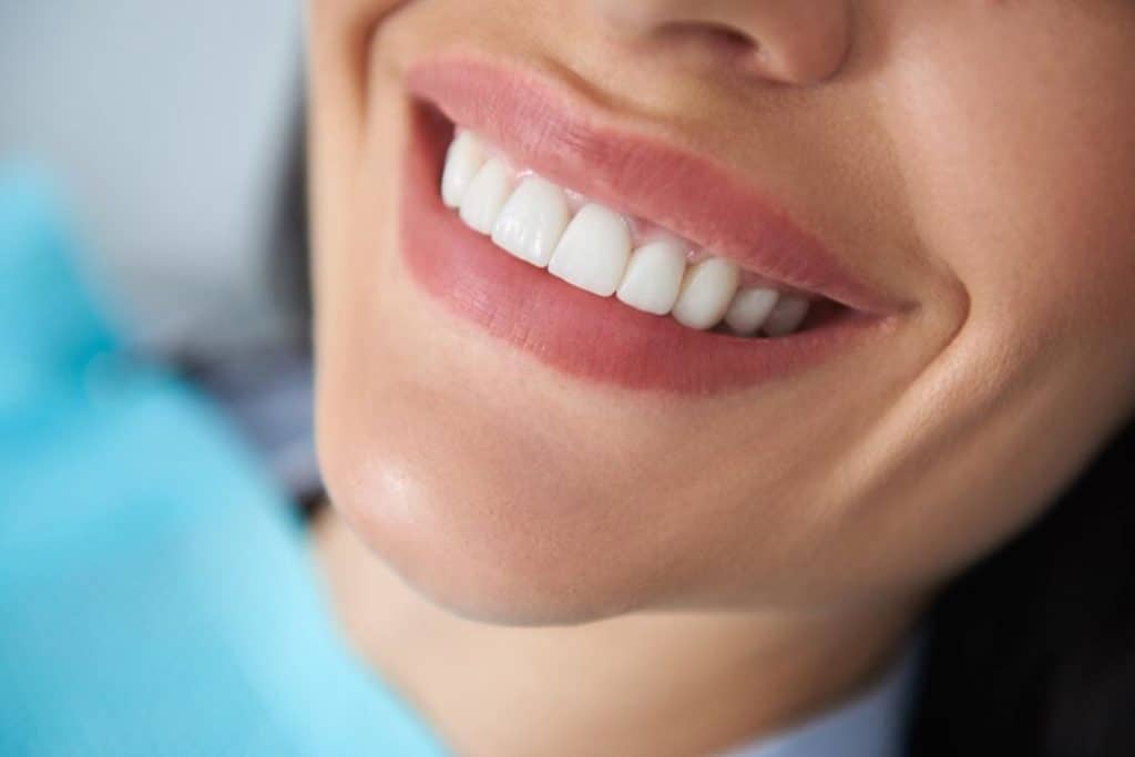 How to Tell If In-Office Teeth Whitening is Right for You ...