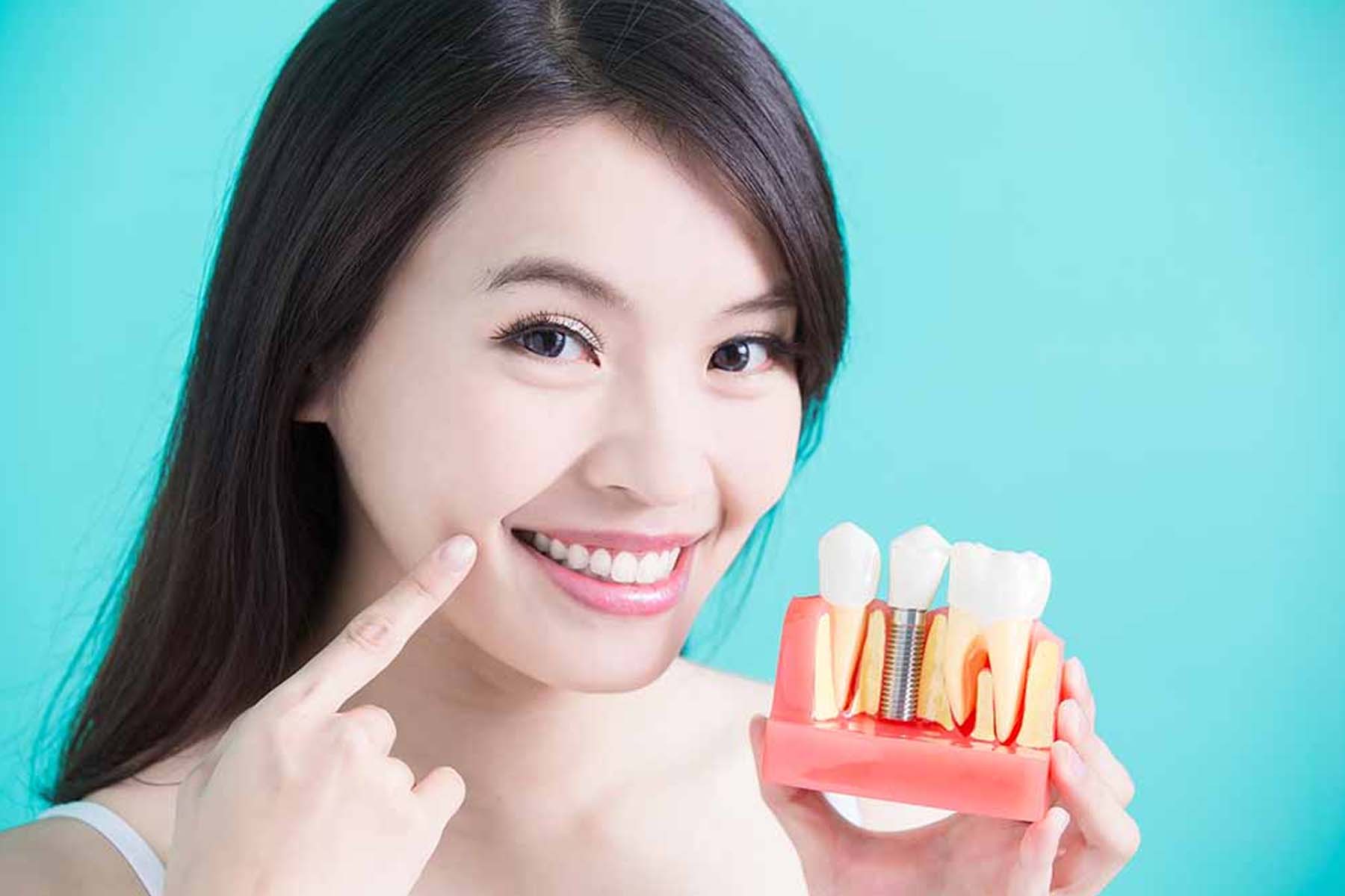 How Long Does It Take to Recover from Dental Implants?