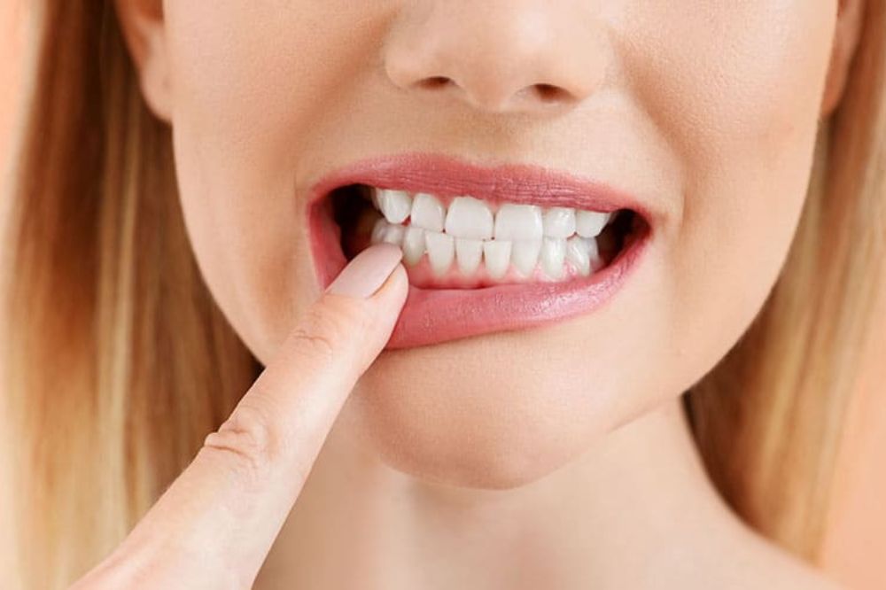 Repairing-Loose-Teeth-for-a-Healthier-Smile-from-Dentist-in-Naples