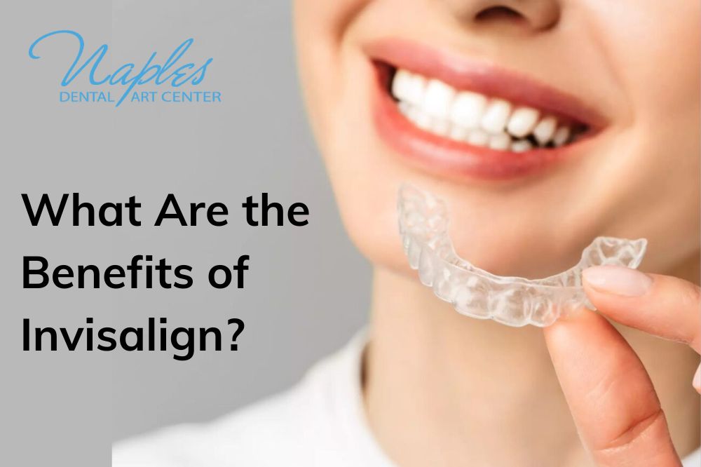 What Are the Benefits of Invisalign?